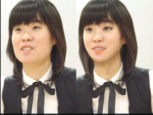 이런튜닝 이미지