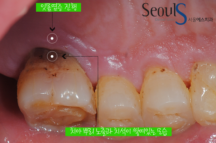 더블클릭을 하시면 이미지를 수정할 수 있습니다